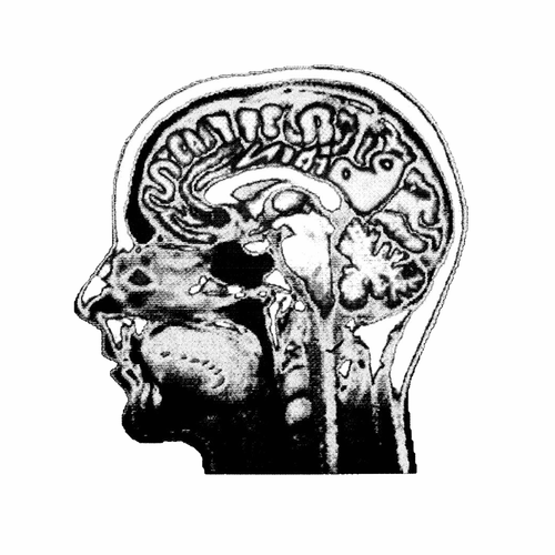 scatterbraincollective